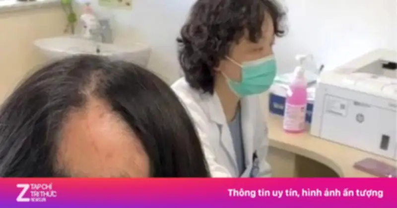 Áp lực dạy con học, người mẹ Trung Quốc bị rụng tóc từng mảng lớn