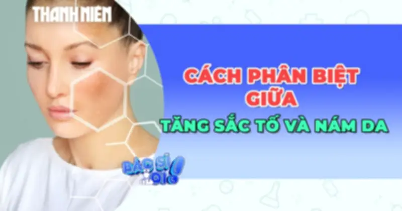 Phân Biệt Tăng Sắc Tố, Nám Da: Bản Chất Khác Biệt Và Cách Xử Lý Đúng