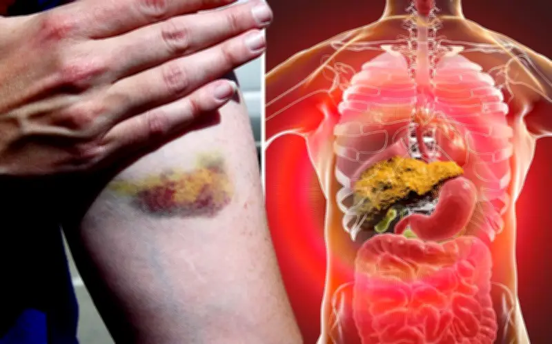 Sau Tết, nhóm người có nguy cơ cao nhiễm độc mà không hay biết