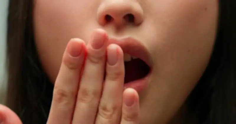 Sỏi Amidan - Thủ Phạm Gây Hôi Miệng Dù Vệ Sinh Răng Miệng Kỹ