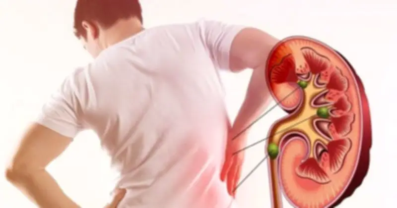 Suy Thận: Dấu Hiệu Âm Thầm Và Các Triệu Chứng Cảnh Báo Cần Biết