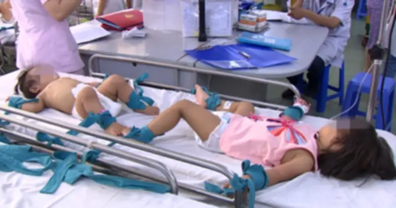 Tay chân miệng bùng phát tại TP HCM: Ca mắc tăng gần gấp đôi, đã có trẻ tử vong