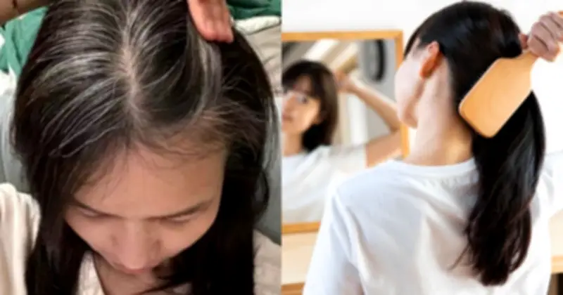 Tóc Bạc Sớm: Nguyên Nhân Từ Thức Khuya, Thuốc Lá Và Cách Phòng Ngừa Hiệu Quả