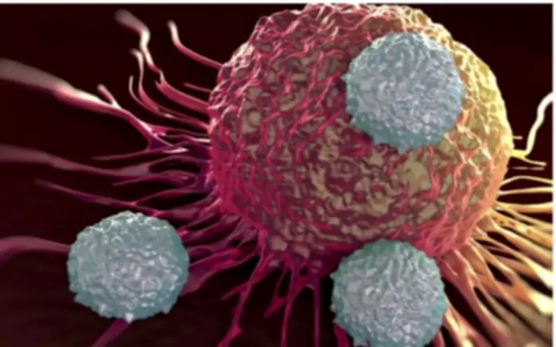 Thanh niên 29 tuổi phát hiện ung thư hiếm gặp từ dấu hiệu nhiều người Việt bỏ qua