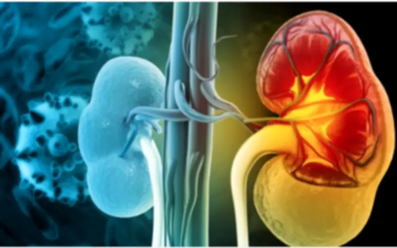 Thói quen ăn uống làm tăng nguy cơ suy thận, nhiều người Việt mắc phải