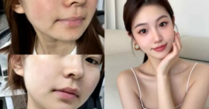 Top 5 Kem Chống Nắng Cho Da Khô: Lựa Chọn Hoàn Hảo Cho Làn Da Ẩm Mịn