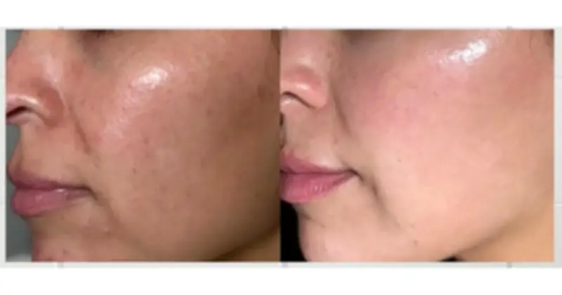 Top 7 kem dưỡng trắng da chống lão hóa cho tuổi 40: Lựa chọn vàng cho làn da rạng rỡ