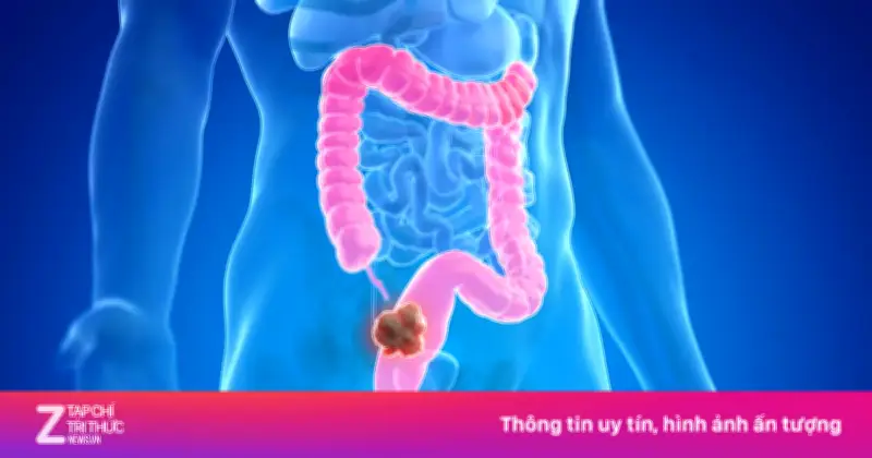 Ung thư đại trực tràng tăng nhanh ở người trẻ: Báo động toàn cầu và câu chuyện từ diễn viên James Van Der Beek