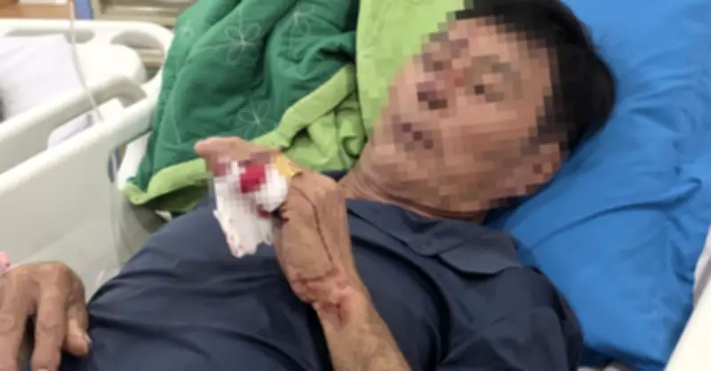 Vụ sạt lở Tổng Cầu Ghềnh: Một nạn nhân phải phẫu thuật khẩn cấp