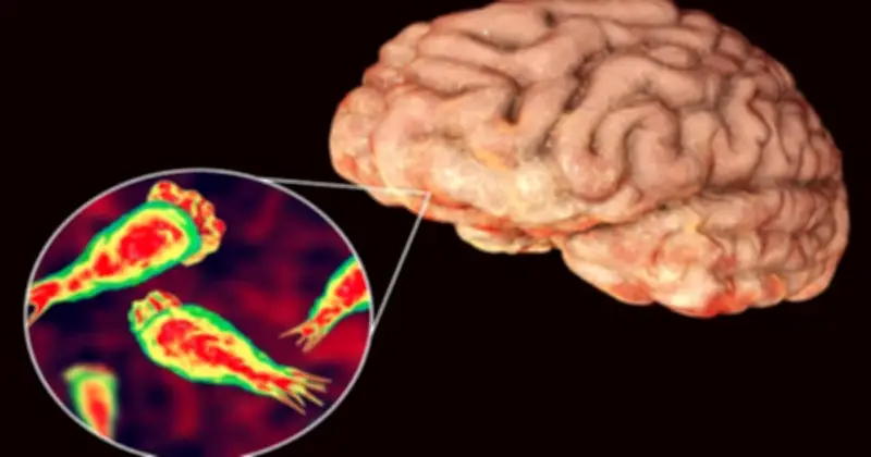 Virus JC: 'Sát thủ não' tiềm ẩn trong cơ thể hàng tỷ người có thể thức tỉnh