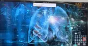 AI hỗ trợ phát hiện ung thư phổi giai đoạn rất sớm, tăng cơ hội điều trị