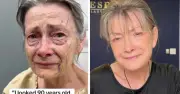 Bác sĩ Mỹ gây sốt với ca căng da mặt giúp phụ nữ 70 tuổi trẻ như 50