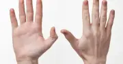 Bàn Tay Cảnh Báo Sức Khỏe: 3 Dấu Hiệu Bất Thường Dễ Bỏ Qua Có Thể Liên Quan Đến Ung Thư