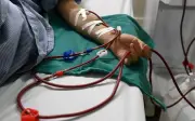 Loại thịt ăn nhiều có thể làm tăng tốc độ suy thận: Người Việt cần hiểu đúng để phòng bệnh