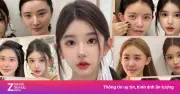 Mang ảnh idol đòi sửa mũi lần 5: Cơn sốt thẩm mỹ theo trend mạng xã hội đầy rủi ro