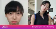 Nữ Thần Điền Kinh Kim Min Gee Lên Tiếng Về Nghi Vấn Dao Kéo Sau Ảnh Quá Khứ