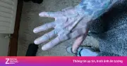 Người Đàn Ông Da Xanh Như Avatar Vì Ga Giường Mới Chưa Giặt