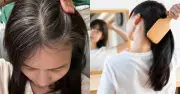 Tóc Bạc Sớm: Nguyên Nhân Từ Thức Khuya, Thuốc Lá Và Cách Phòng Ngừa Hiệu Quả
