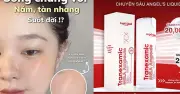 Top 3 Serum Tranexamic Acid: Giải Pháp Làm Mờ Nám, Đều Màu Da Hiệu Quả