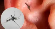 Vì sao muỗi luôn vo ve bên tai dù dễ bị phát hiện và tiêu diệt?