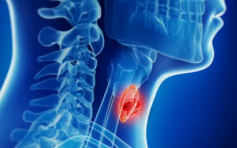 Bé 13 tuổi phát hiện ung thư tuyến giáp từ dấu hiệu nhiều người Việt mắc phải