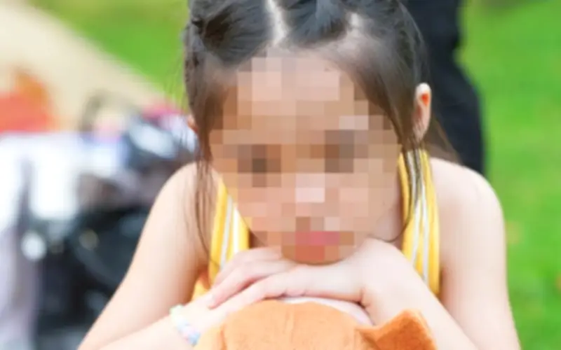 Bé gái 5 tuổi ngực to bất thường, phát hiện mắc buồng trứng dậy thì sớm