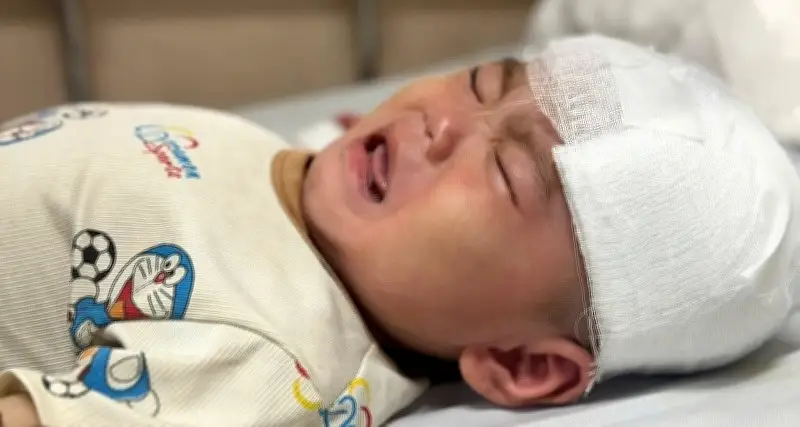 Bé trai 1 tuổi ngã nguy kịch, gia đình bán cả con trâu không đủ tiền điều trị