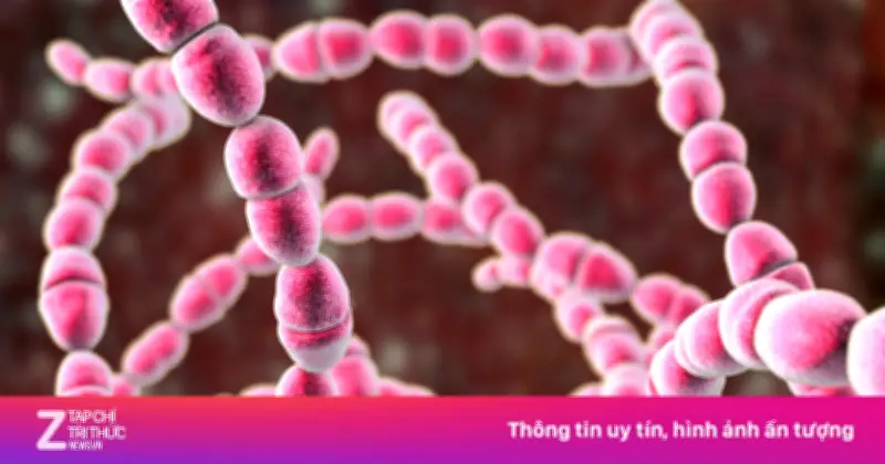 Bé trai 11 tuổi viêm cầu thận sau nhiễm liên cầu khuẩn, cảnh báo biến chứng nguy hiểm