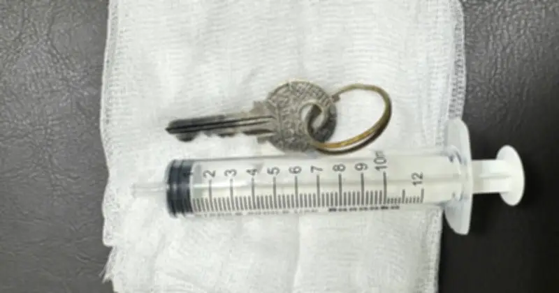 Bé trai 14 tuổi nuốt chìa khóa, nhập viện cấp cứu giữa đêm