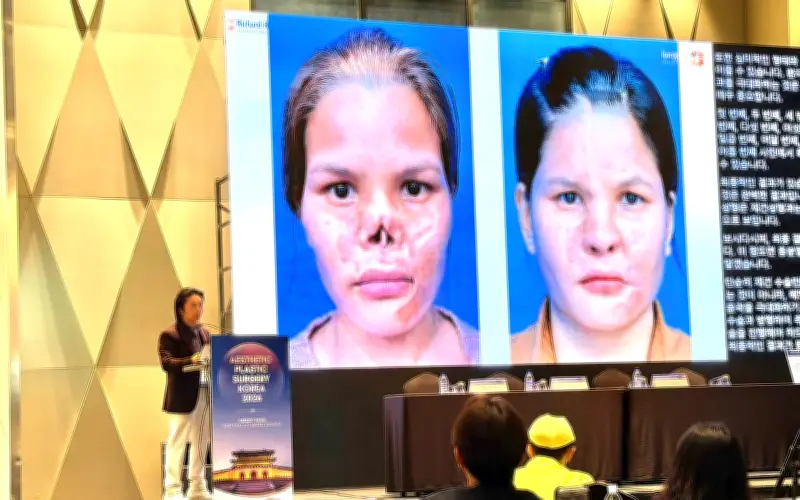 Biến chứng nâng mũi gia tăng: Thách thức lớn trong phẫu thuật thẩm mỹ tại Việt Nam