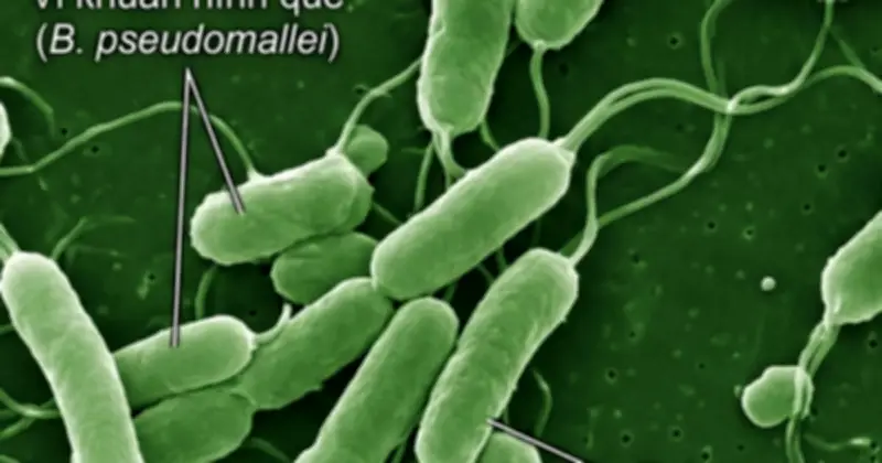 Bệnh 'sốt đất' nguy hiểm: Dấu hiệu, điều trị và phòng ngừa