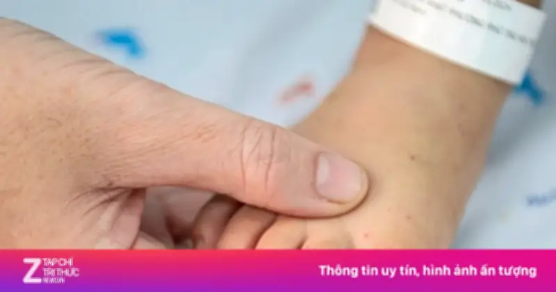 Bệnh Tay Chân Miệng Bùng Phát: Bác Sĩ Bạch Mai Cảnh Báo Nguy Cơ Từ Virus EV71