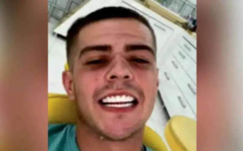 Buôn ma túy bị bắt sau khi khoe ảnh tẩy trắng răng trên điện thoại bạn