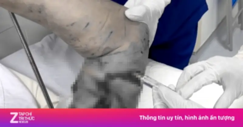 Cụ bà Hải Phòng bị chó becgie 30kg cắn trọng thương, phải phẫu thuật khẩn và tiêm phòng dại