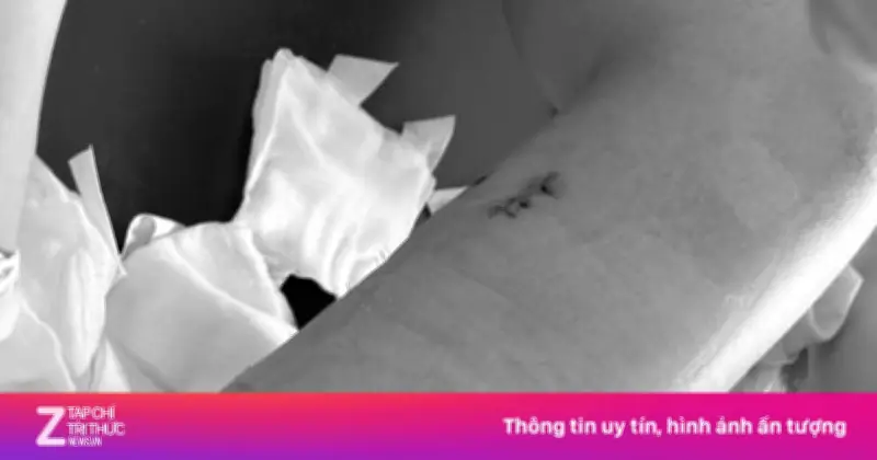 Cô Gái 25 Tuổi Thoát Cắt Cụt Chân Sau Tai Nạn Xe Tải Kéo Lê, Bác Sĩ Hút Gần 2 Lít Dịch