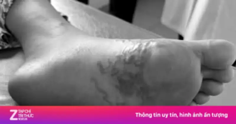 Ca nhiễm giun lươn hiếm gặp khiến bác sĩ ngỡ ngàng, bệnh nhân 62 tuổi thoát hiểm