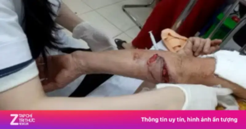 Chó lạ hung hãn tấn công ba phụ nữ đi tập thể dục tại Nghệ An