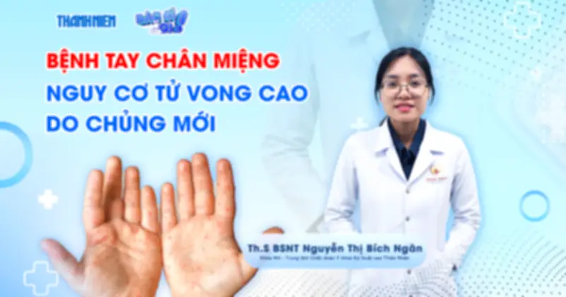 Chủng EV71 gây tay chân miệng: Nguy cơ tử vong cao đe dọa trẻ nhỏ dưới 5 tuổi