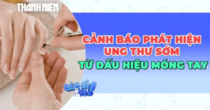 Cảnh báo: Dấu hiệu trên móng tay có thể cảnh báo sớm ung thư hiếm gặp
