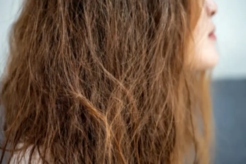 Cảnh báo: Lạm dụng protein có thể gây hư tổn và rụng tóc nghiêm trọng