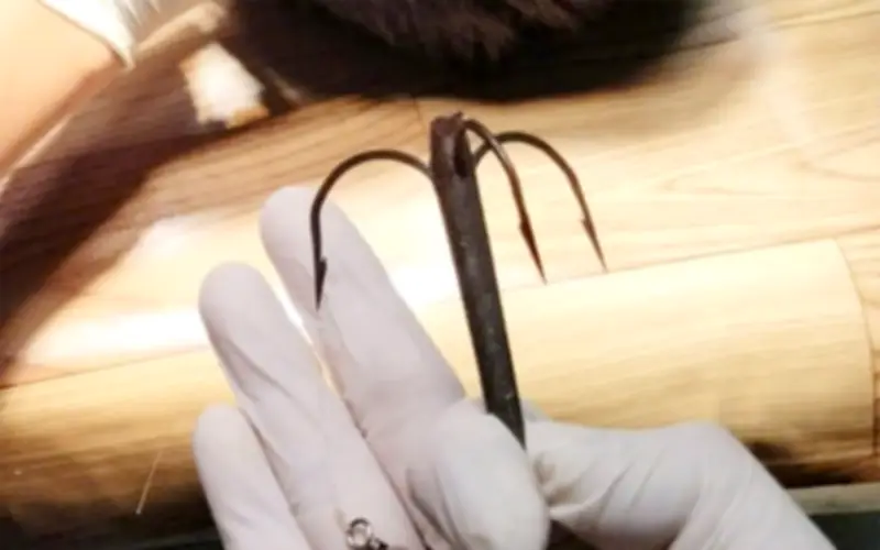 Cảnh báo tai nạn câu cá: Thiếu niên bị lưỡi câu ba tiêu cắm sâu vào đỉnh đầu