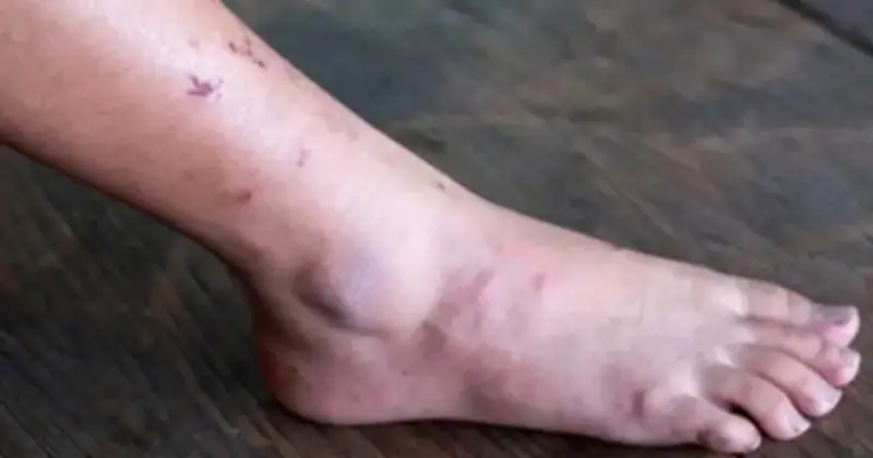 Cảnh báo ung thư: 3 dấu hiệu bất thường dễ bị bỏ qua, đừng chủ quan khi cơ thể 'lên tiếng'