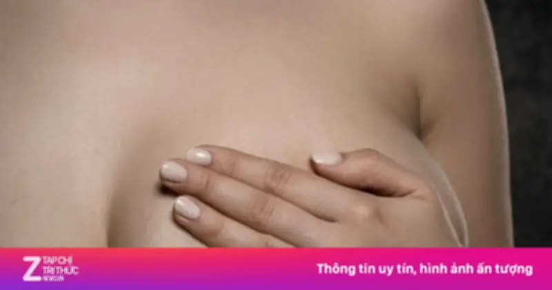 Du học sinh 26 tuổi nhập viện vì khối u vú phát triển nhanh như trái bưởi