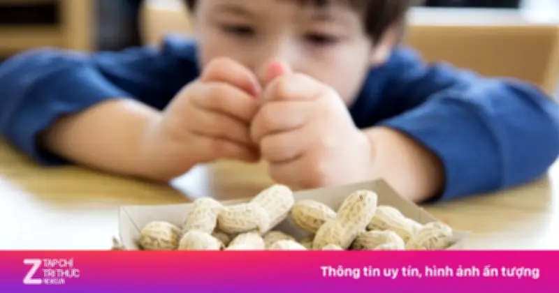 Dấu hiệu cảnh báo dị ứng thức ăn ở trẻ nhỏ và cách xử trí kịp thời