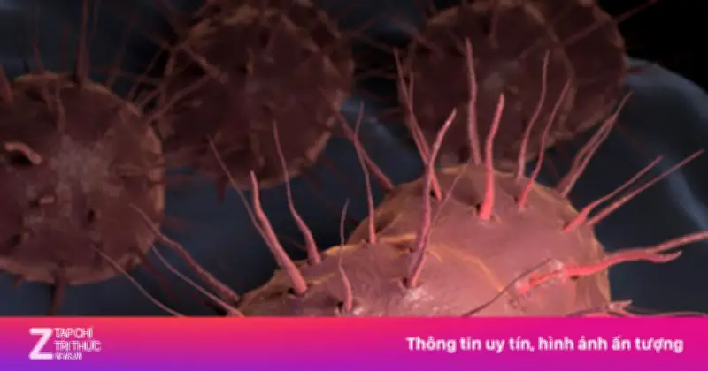 Dấu Hiệu Nhận Biết Bệnh Lậu Ở Nam Giới: Triệu Chứng, Biến Chứng Và Cách Phòng Tránh