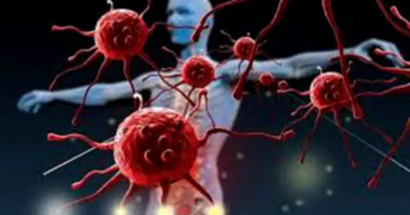 Dấu Hiệu Ung Thư Giai Đoạn Sớm: Mệt Mỏi, Sụt Cân, Đau Âm Ỉ Không Nên Bỏ Qua