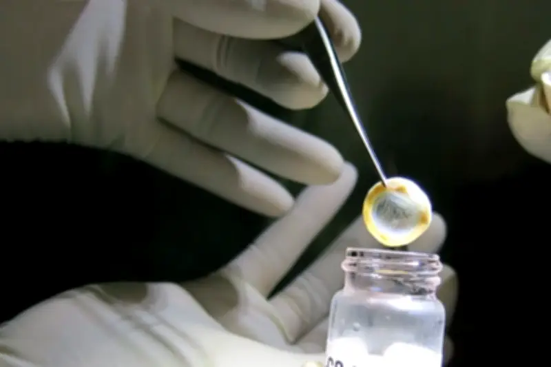 Hơn 500.000 người Việt bị mù do các bệnh lý về giác mạc