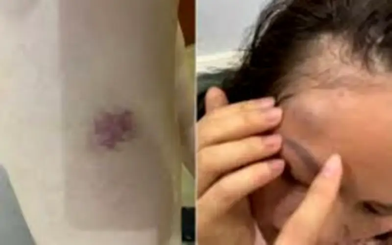 Hàng xóm hành hung mẹ con vì mâu thuẫn khói thuốc lá tại Hà Nội