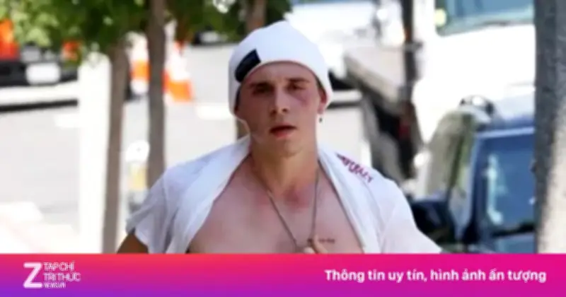 Mâu Thuẫn Gia Đình Beckham: Brooklyn 'Im Lặng' Trong Sinh Nhật Victoria