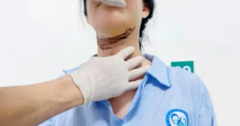 Nữ sinh Quảng Trị bị thương nặng do vướng dây chắn ngang đường, sức khỏe đã ổn định